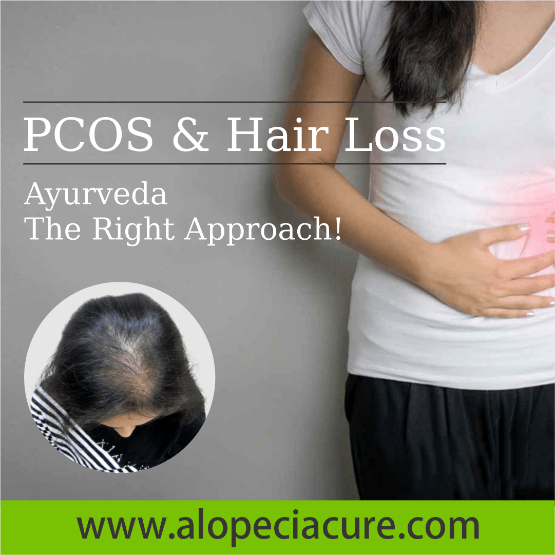 pcos related hair loss